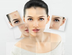Skin Whitening Treatment - Luvayaa